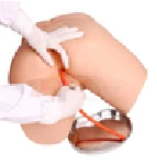Adult Size Enema Training Model 15B