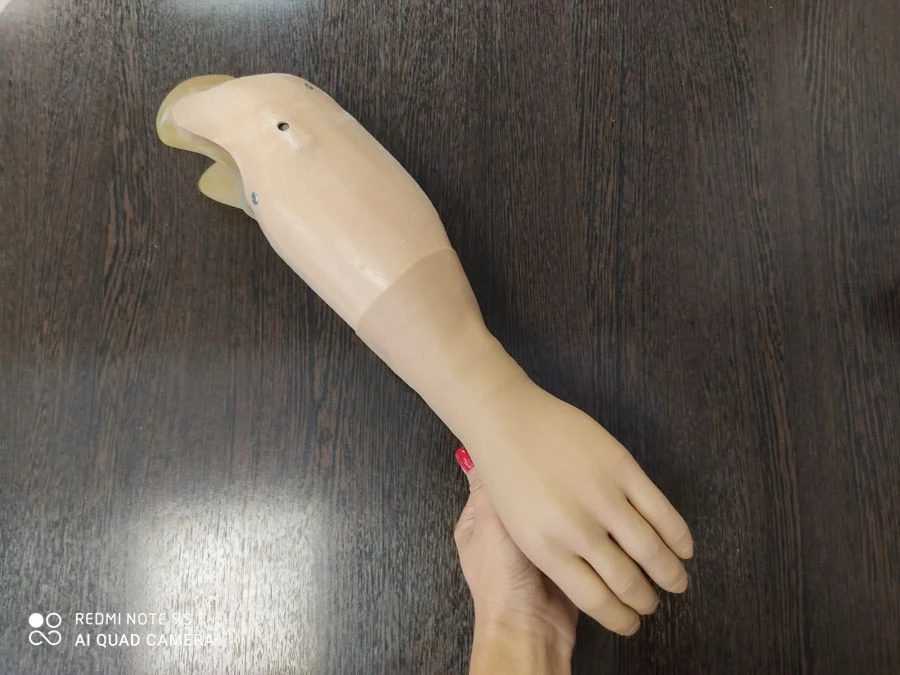 Cosmetic Forearm Prosthesis for Upper Limb Rehabilitation