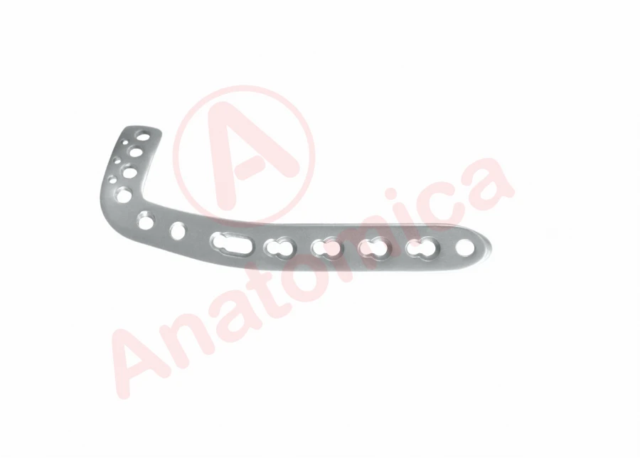 Distal Anterolateral Tibial L-Plate with Angular Stability for Limited Contact