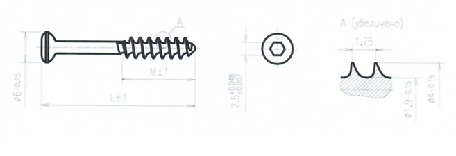 Titanium Alloy Sponge Screw 4.0mm 60mm