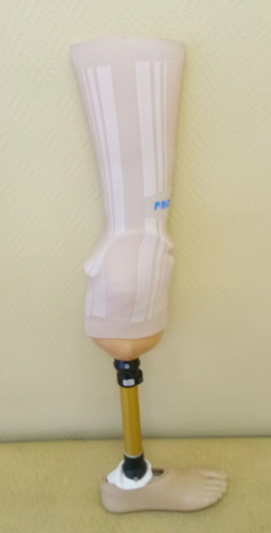 Modular Below-Knee Prosthesis for Congenital Deficiency