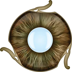 Monolithic Polymer IOL with Integrated Iris for Amblyopia Treatment