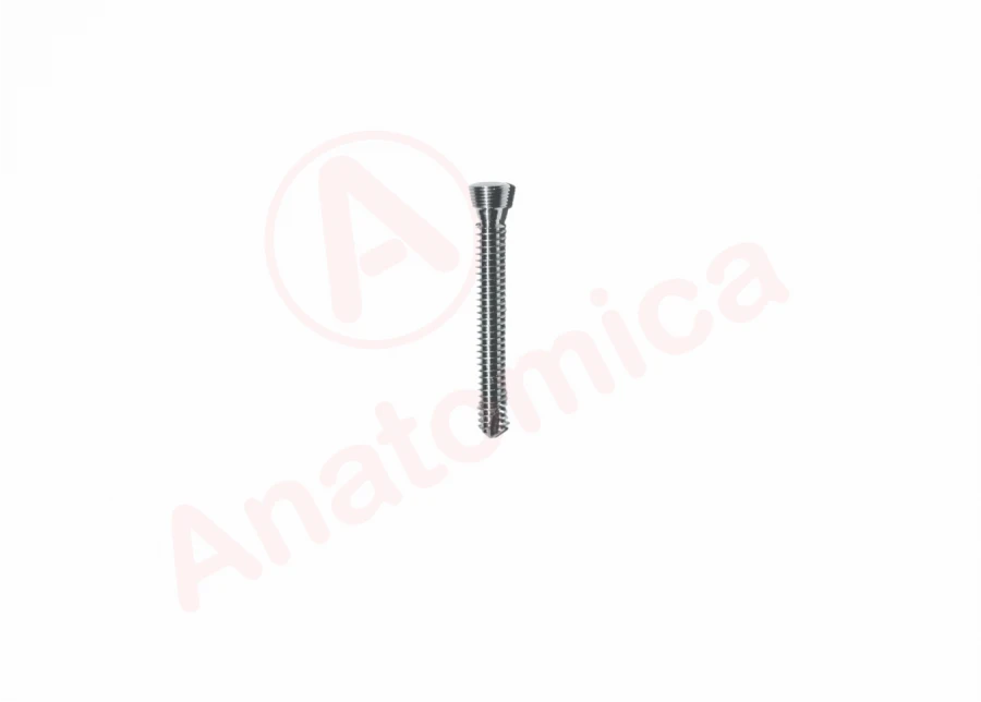 Conical Threaded Spongy Screw for Bone Fracture Fixation