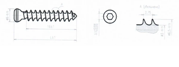 Solid Threaded Spongy Screw 6.5mm x 80mm