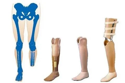 Therapeutic Training Shin Prosthesis for Rehabilitation