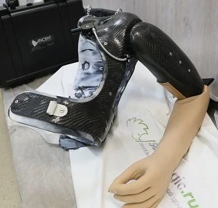 Electromechanical Arm Prosthesis with Control Contact System