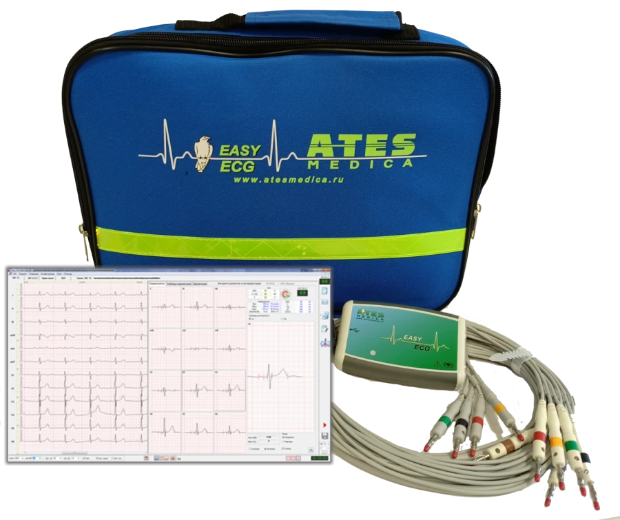 EASY ECG Modular System for Remote ECG Registration and Analysis