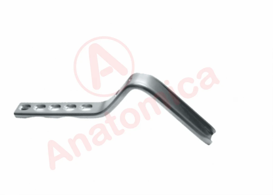 لوحة زاوية 120° مع اتصال محدود لتثبيت الكسور