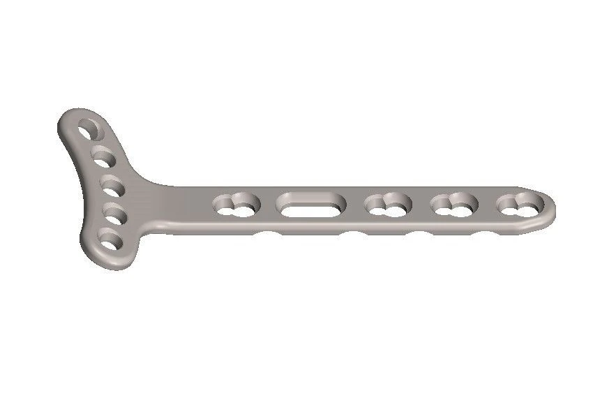 Distal Radius Bone Plate with Angular Stability, Article 90.04.XXX