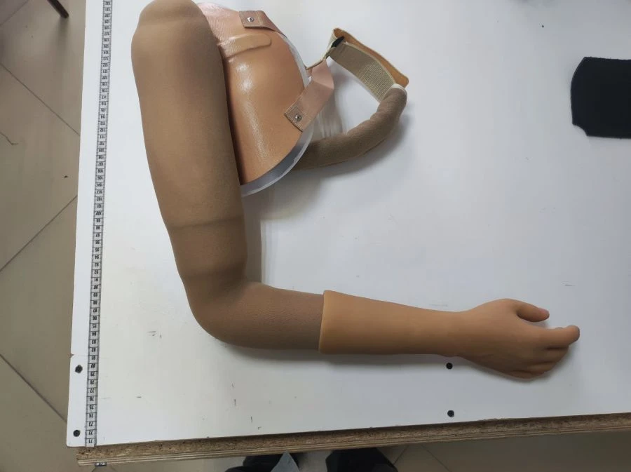 Functional-Cosmetic Prosthesis for Above-Elbow Amputation