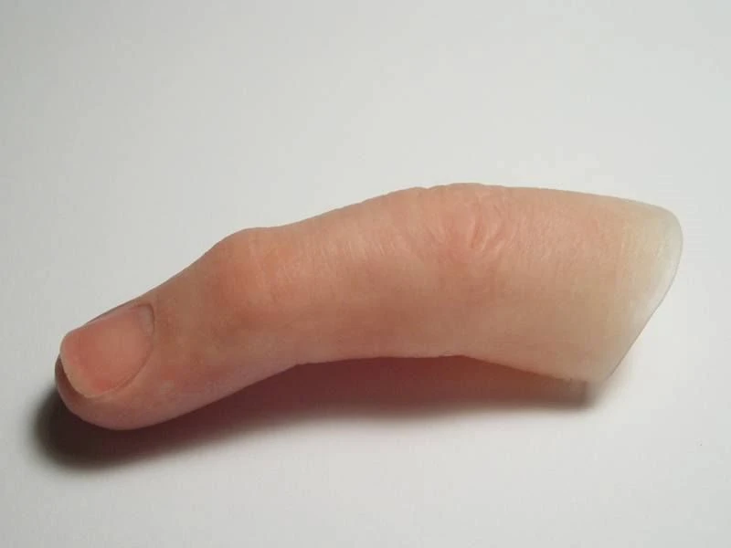 Cosmetic Finger Prosthesis for Aesthetic Restoration