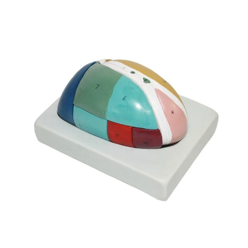 Enlarged Thalamus Model, 18213