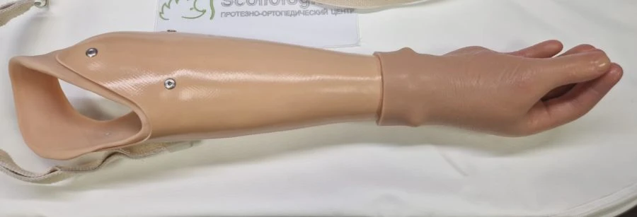 Active Forearm Prosthesis (Tensile Type)