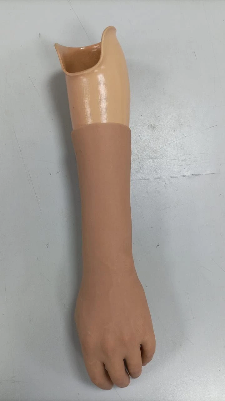 Cosmetic Forearm Prosthesis with Sliding Coating and Acrylic Nails