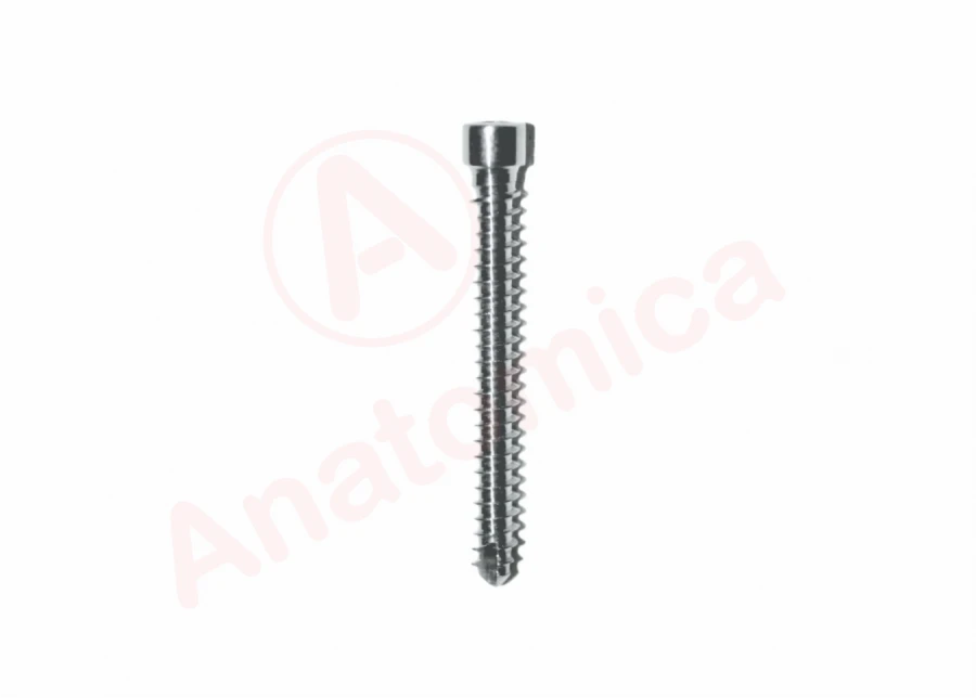 Distal Locking Screw for Bone Fractures