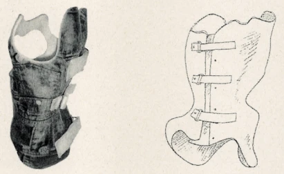 Functional Corrective Corset for Lumbar Spine - Sheno KR4SH