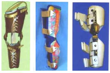 Knee Joint Rehabilitation Device - Custom Fit