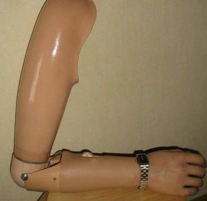 Functional-Cosmetic Prosthesis for Shoulder Amputation