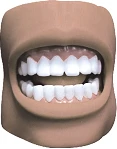 نموذج الأسنان (في الفم)، K4