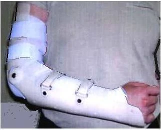 Wrist and Elbow Joint Rehabilitation Device