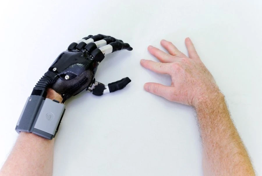 طرف صناعي لليد مزود بتحكم ميكرومعالجي