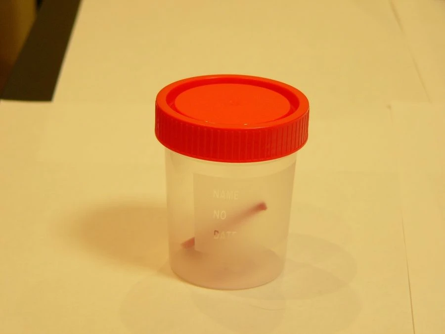 Disposable Non-Sterile Polymer Container for Biological Samples - 120ml with Spoon