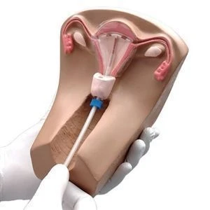 Intrauterine Contraception Demonstration Trainer, B3