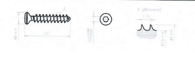 Titanium Alloy Solid Threaded Spongy Screw 4.0mm 10mm