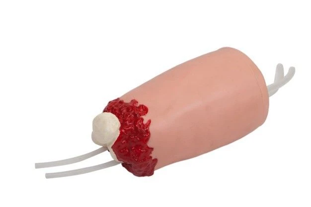 Life-size Lower Limb Model with Amputation Trauma H3008