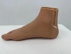 Foot Prosthesis for Moderate Neuromuscular Disorders