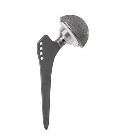 Cementless Hip Joint Prosthesis with Metal-Polyethylene Friction Pair