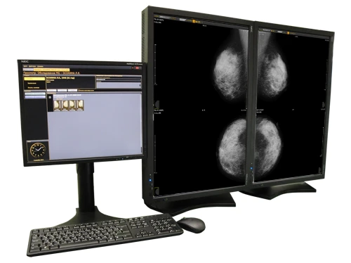 Automated Workplace for Radiologists "DIARM-MT-Plus