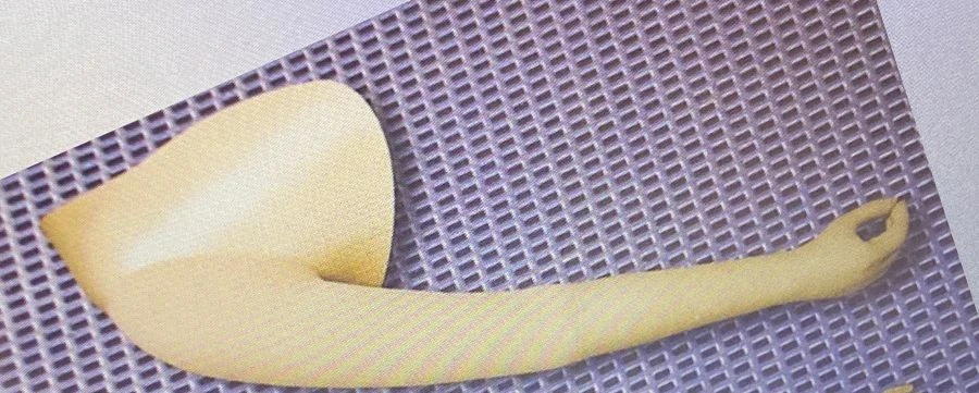 Functional-Cosmetic Arm Prosthesis for Post-Amputation