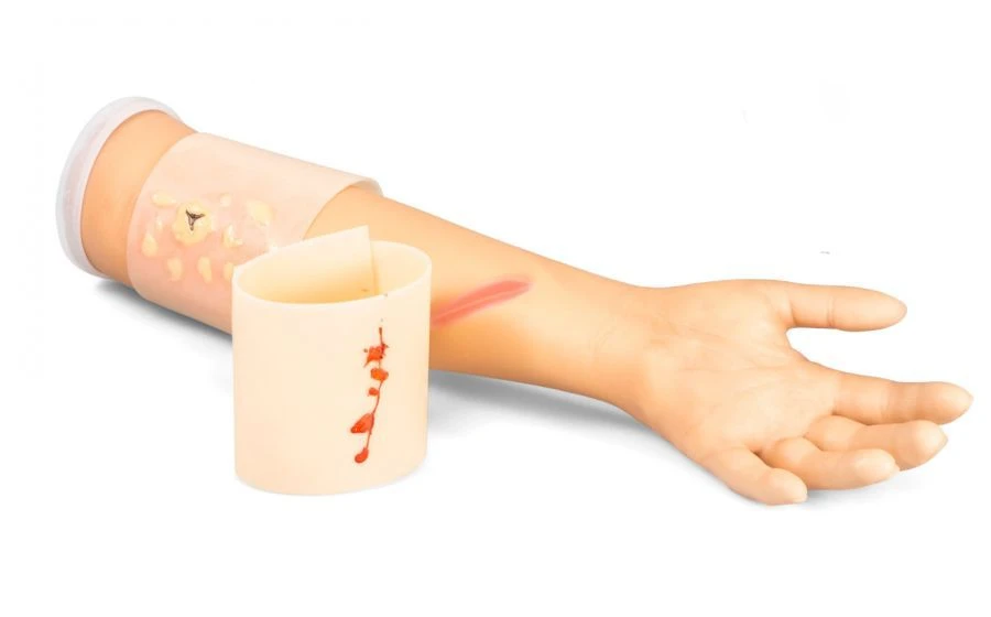 Phantom Hand with Forearm for Burn and Wound Treatment, ZIK-18