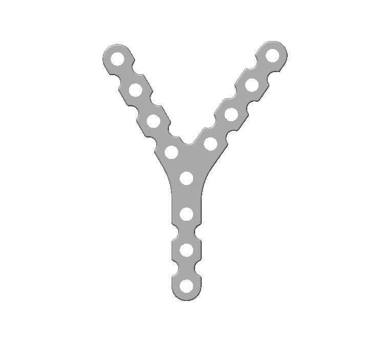 Y-Shaped Titanium Alloy Plate for Distal Humerus Fractures, Article 93.18.XXX