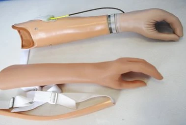 Active Forearm Prosthesis (Tension Type)