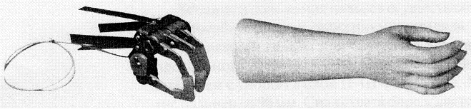 Active Hand Prosthesis for Partial Hand Amputation PР0-22-1