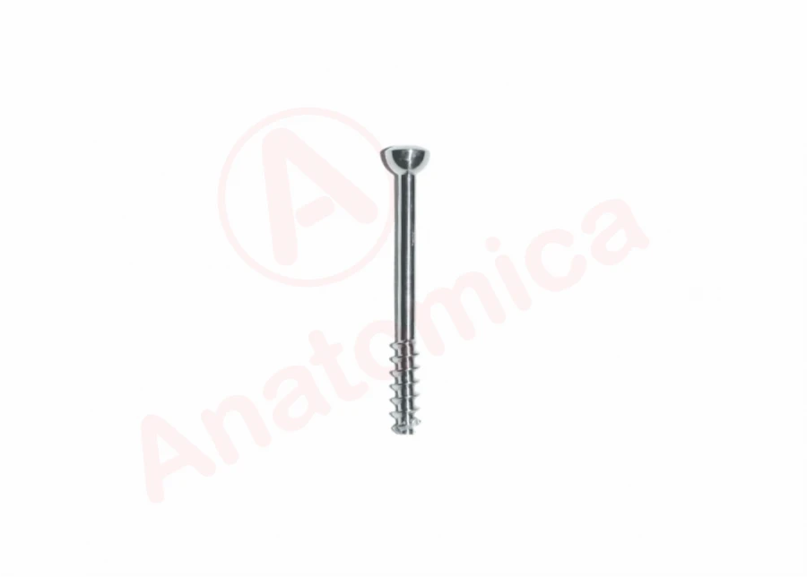 Cannulated Bone Screw for Fracture Fixation