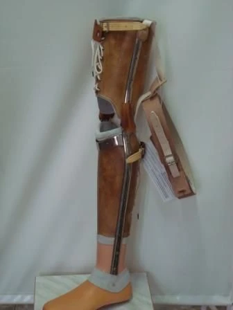 طرف صناعي غير نمطي للفخذ