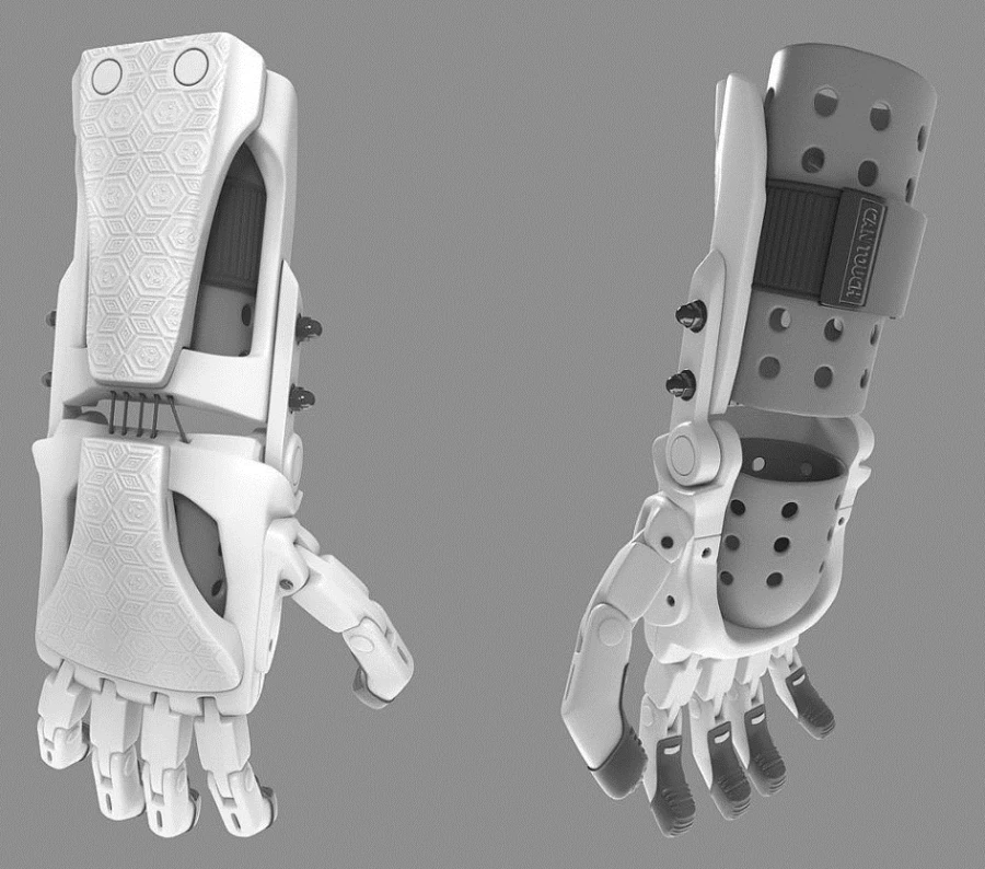 Active Prosthetic Hand for Amputees and Congenital Defects