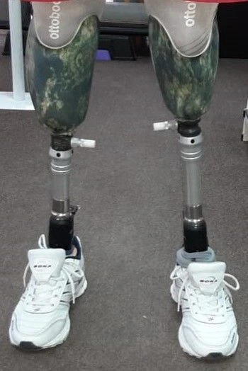 Modular Lower Leg Prosthesis for Individuals with Limb Development Issues