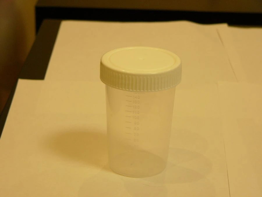 Disposable Non-Sterile Polymer Container for Biological Samples 150ml (KOP)