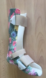 Ankle Joint Brace for Corrective Positioning