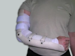 Custom Elbow Joint Apparatus for Rehabilitation