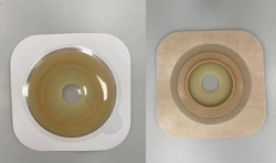 Stoma Rehabilitation Product for Colostomies, Ileostomies, and Urostomies: Flat Plate, Convex Plate