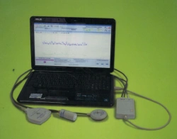 Fetal Monitoring Computerized Monitor MAС-02-"Ch