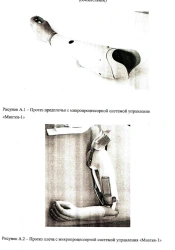 Upper Limb Prosthesis with External Power Source PR2-B1