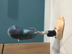 Microprocessor-Controlled Below-Knee Prosthesis