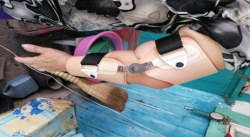 Orthopedic Elbow Joint Device for Upper and Lower Limbs