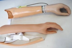 Microprocessor-Controlled Forearm Prosthesis